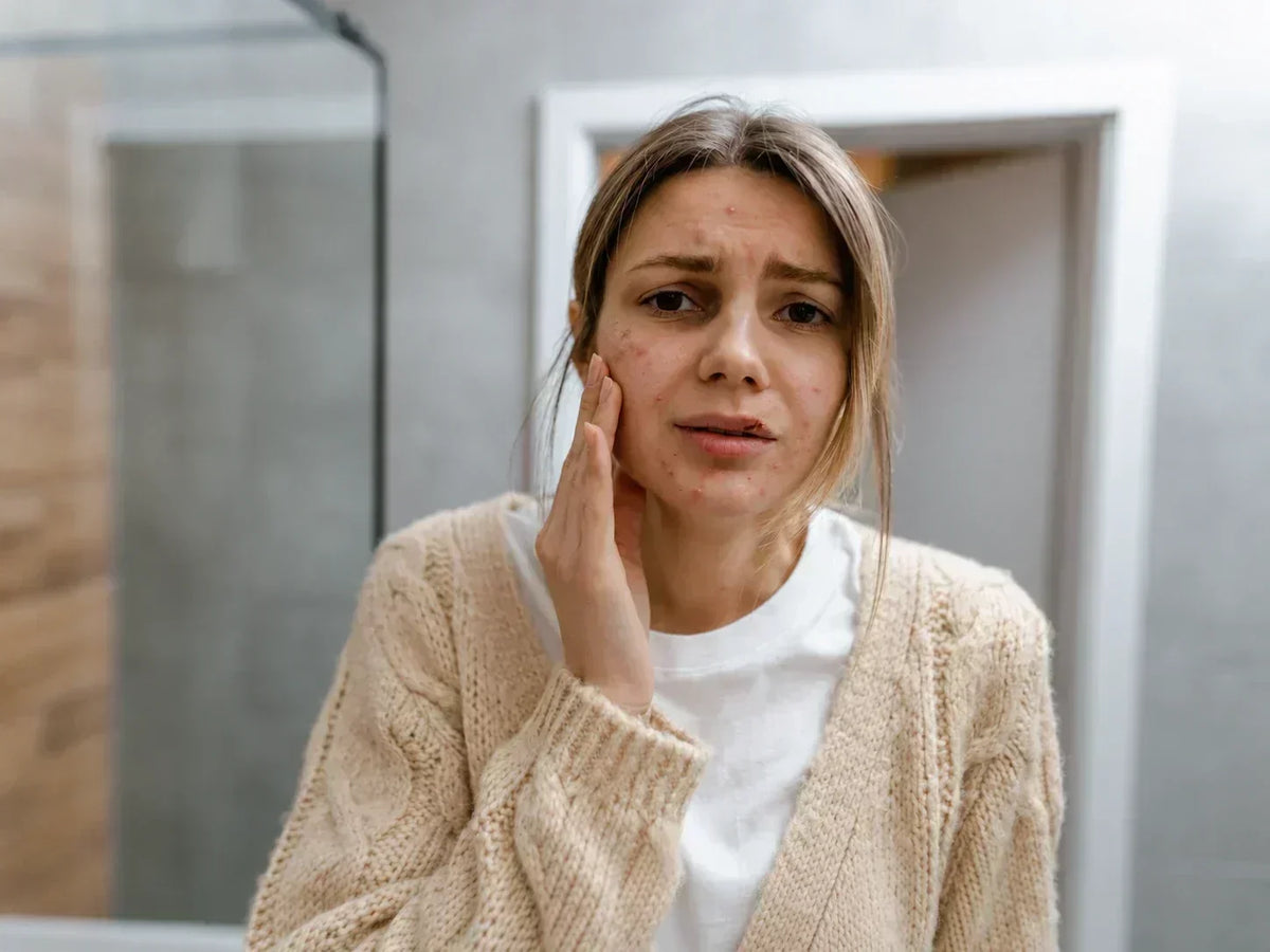 Alt text (CZ):   Kopírovať  Žena s pupínky a podrážděnou pletí se dotýká tváře a sleduje zhoršení stavu pokožky po změně skincare rutiny.